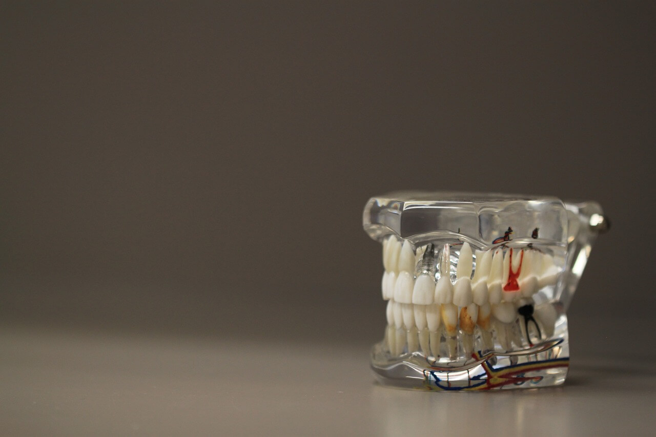 dentistry-668191_1280